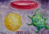 Rob van der Schoor verwerkte behandeling leukemie met kunst